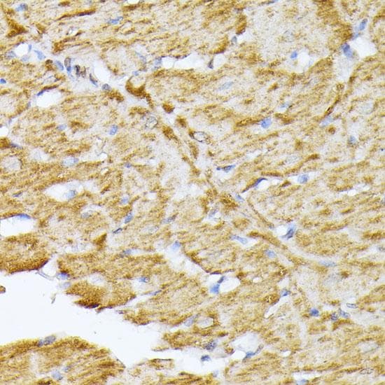 ANT2 / SLC25A5 Antibody