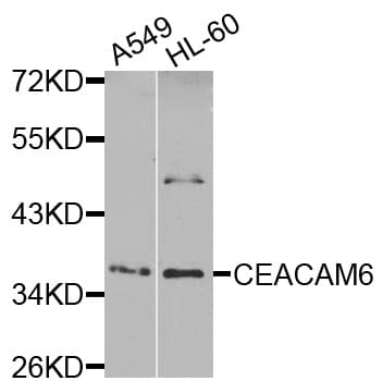 Polyclonal Rabbit anti-Human CD66c / CEACAM6 Antibody (WB)