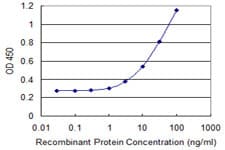 IHC-plus™ SIK1 / MSK Antibody (clone 2C12)