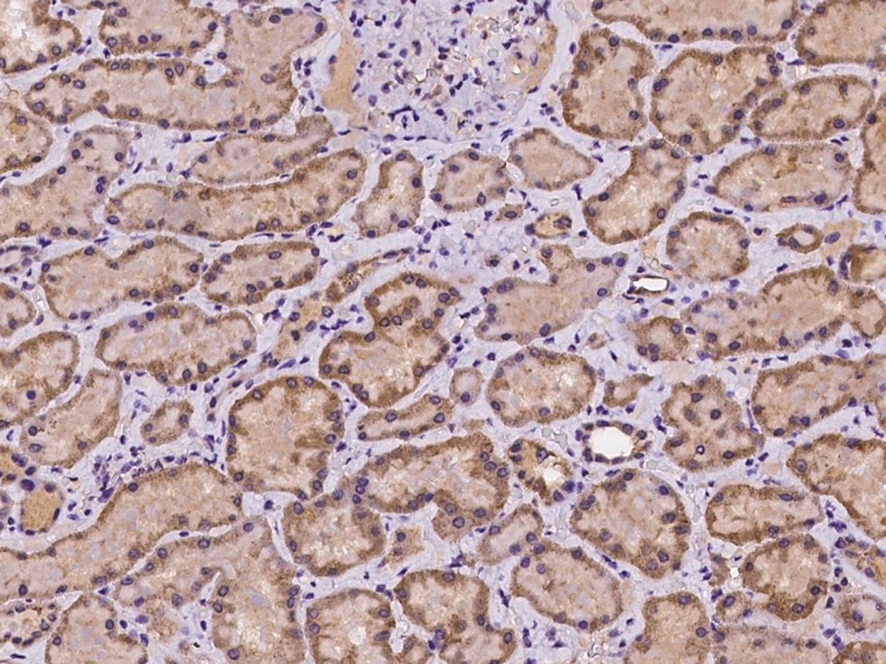 CD119 / IFNGR1 Antibody