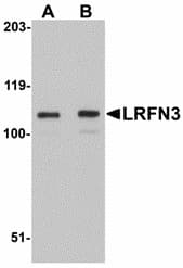 IHC-plus™ LRFN3 Antibody