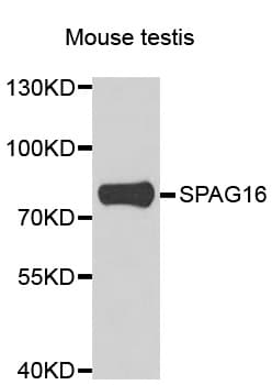 Polyclonal Rabbit anti-Human SPAG16 Antibody (IHC, WB)