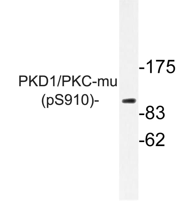 Polyclonal Rabbit anti-Human PRKD1 / PKC Mu Antibody (phospho-Ser910, IHC, WB)