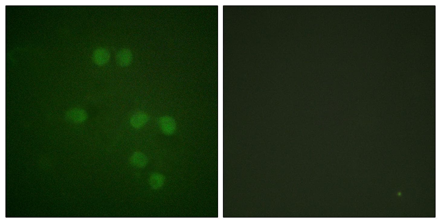 HMGN1 / HMG14 Antibody