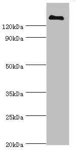 CFH / Complement Factor H Antibody (aa20-270)