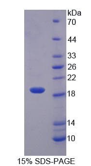 Human IL1F10 Protein (Recombinant His-T7)