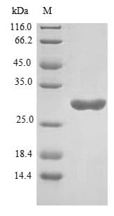 Human FGF7 / KGF Protein (Recombinant 6His-B2M, N-terminus)