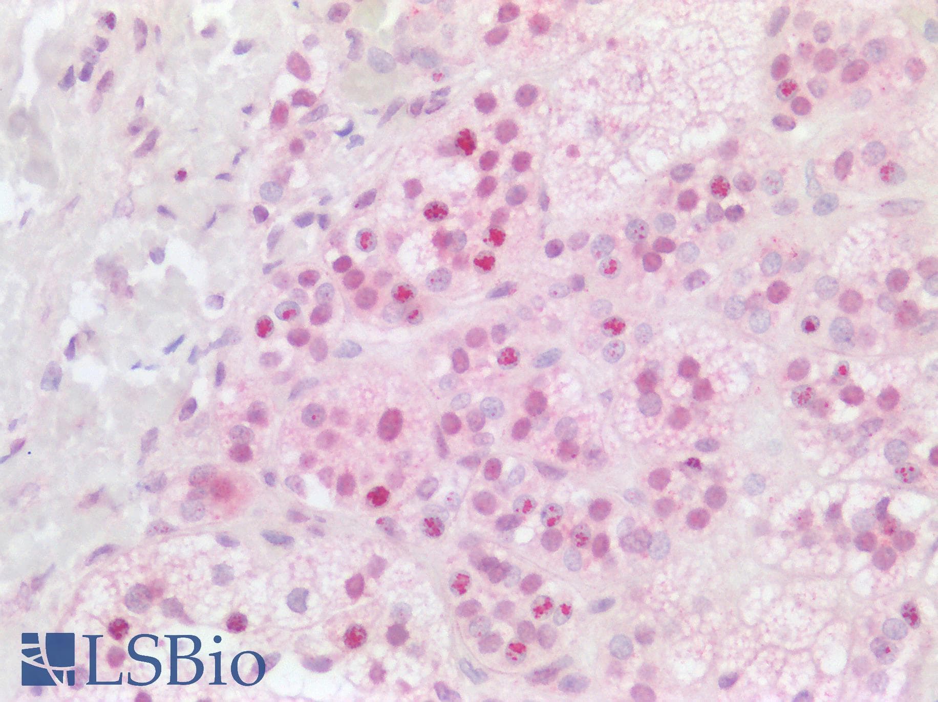 PathPlus™ HES1 / HES-1 Antibody (clone OTI1B5)