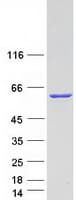 Human ANXA11 / Annexin XI Protein (Recombinant Myc-DDK (Flag))