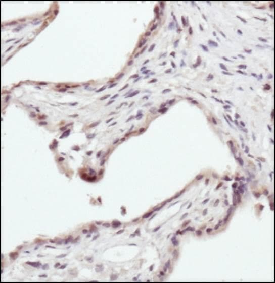 EPOR / EPO Receptor Antibody (aa300-400)