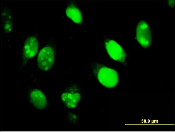 IHC-plus™ IFI16 Antibody (clone 2E3)