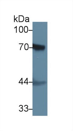 F2 / Prothrombin / Thrombin Antibody (aa201-323)