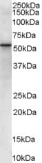 IHC-plus™ VPS45 Antibody (aa294-307)