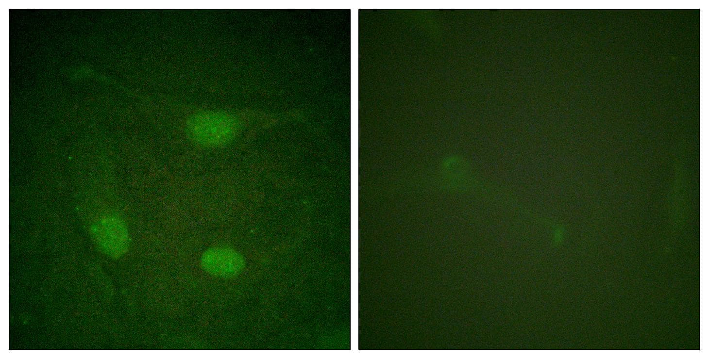 ELK3 / NET Antibody (phospho-Ser357)