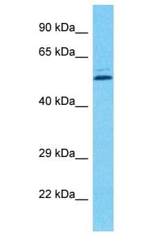 PCYOX1L Antibody (aa357-406)
