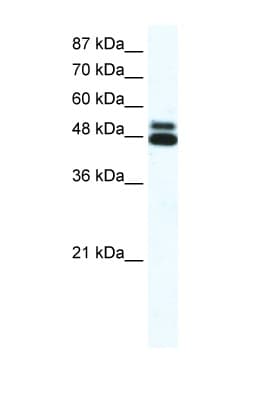 Polyclonal Rabbit anti-Human CHRNB2 Antibody (aa21-70, IHC, WB)