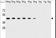 Monoclonal Mouse anti-Vaccinia Virus Vaccinia Virus H1L Antibody (clone 20CT26.44.10.3 / 20CT26.44.10.14, WB)