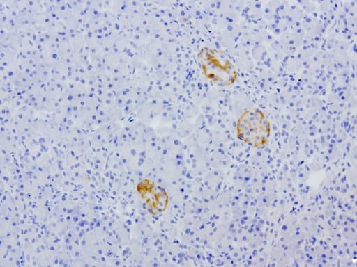 Monoclonal Mouse anti-Human VILIP / VSNL1 Antibody (clone UMAB116, aa2-191, IHC, IF, WB)