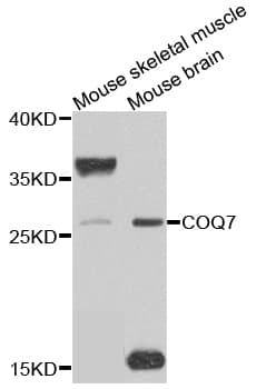 Polyclonal Rabbit anti-Human COQ7 Antibody (IHC, WB)