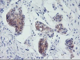 Monoclonal Mouse anti-Human MLF1 Antibody (clone OTI1B9, IHC, WB)