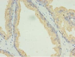 LAMP2 / CD107b Antibody