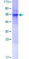 Human KIAA1191 Protein (Recombinant GST)