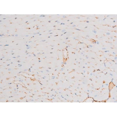 Polyclonal Rabbit anti-Human DNM1 / Dynamin Antibody (phospho-Ser774, IHC, WB)
