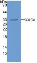 LPL / Lipoprotein Lipase Antibody (aa55-316, FITC)