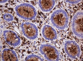 EMA / MUC1 Antibody (clone OTI2E3)