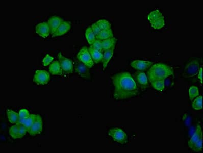 PHGDH Antibody