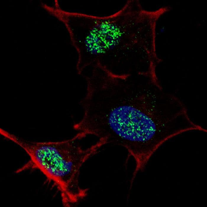 KLF4 Antibody (Ser457)