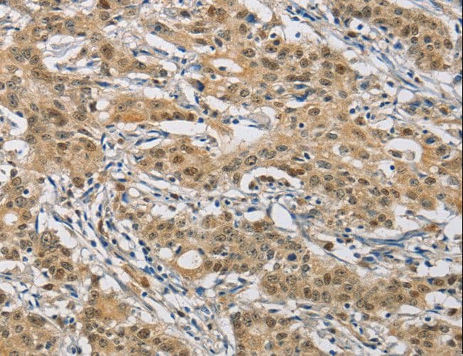 IHC-plus™ NAPSA / NAPA / Napsin A Antibody