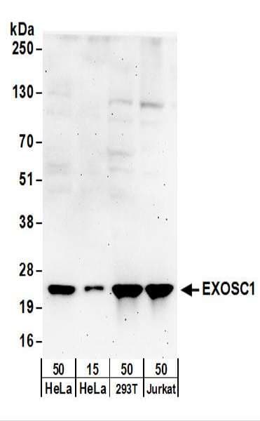 EXOSC1 / CSL4 Antibody (aa145-195)