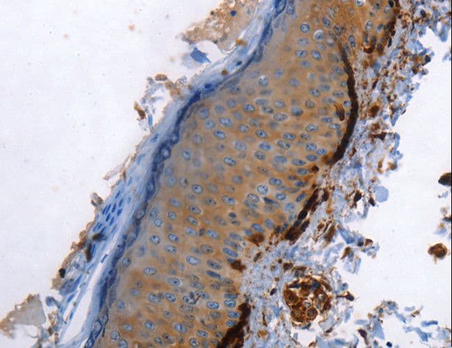 CALD1 / Caldesmon Antibody