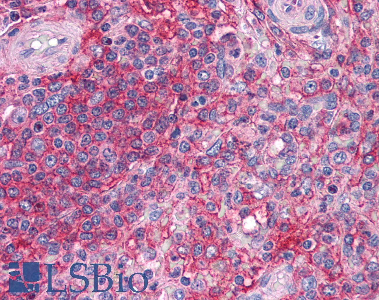 IHC-plus™ Polyclonal Rabbit anti-Human SNAP23 / SNAP-23 Antibody (IHC, WB)