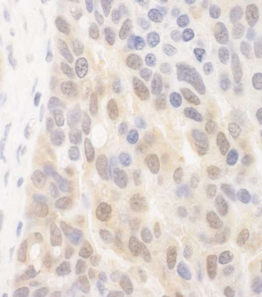SPATA2 Antibody (aa250-300)