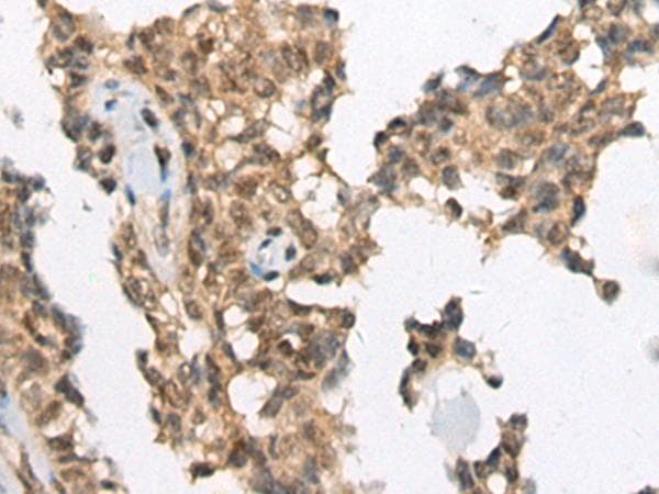 ATRX Antibody