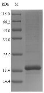 Human CST9 Protein (Recombinant 6His, N-terminus)