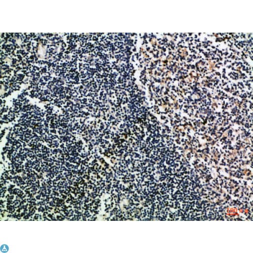 Polyclonal Rabbit anti-Human CD52 Antibody (WB)