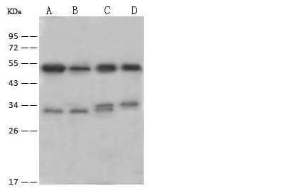 BCKDK Antibody