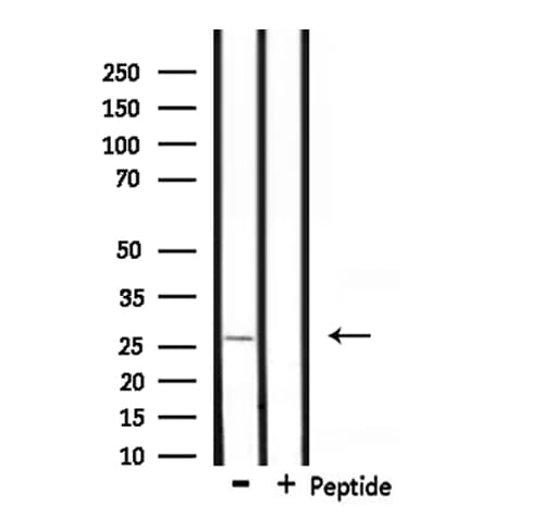 Polyclonal Rabbit anti-Human UBTD2 Antibody (IF, WB)