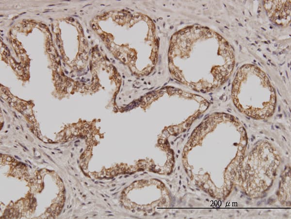 PSMD5 Antibody (clone 3E2)