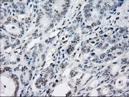 Monoclonal Mouse anti-Human ZFP36 / Tristetraprolin Antibody (clone OTI8B5, IHC, IF, WB)