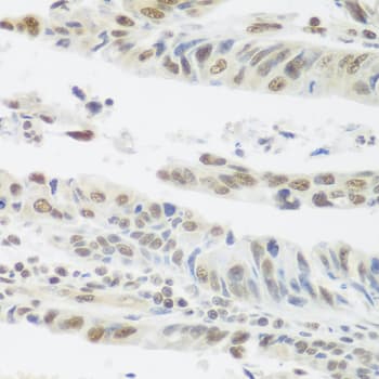 SNAI1 / SNAIL-1 Antibody