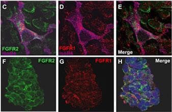 FGFR2 / FGF Receptor 2 Antibody (aa22-51)