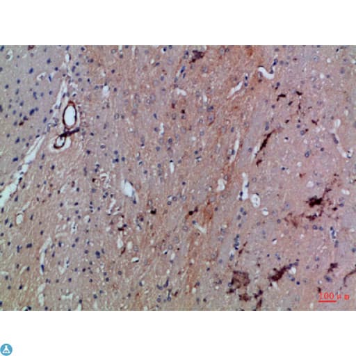 SLC6A1 / GAT-1 Antibody