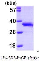 Human DCK / Deoxycytidine kinase Protein (Recombinant His)