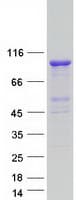 Human TBC1D5 Protein (Recombinant Myc-DDK (Flag))