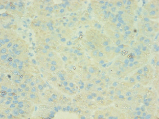 C4BPB / C4BP Beta Antibody (aa18-252)