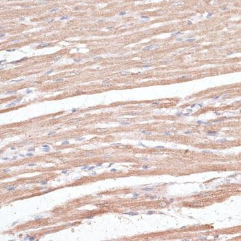 TWIK1 / KCNK1 Antibody